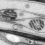 Electronmicrograph of ciliary dilations (follow link for full figure and legend)